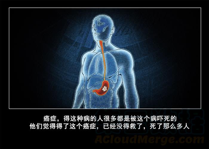 癌症04-催眠师-奋斗的蚊子（第1张）